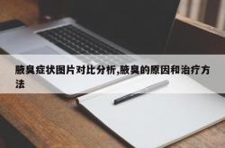 腋臭症状图片对比分析,腋臭的原因和治疗方法